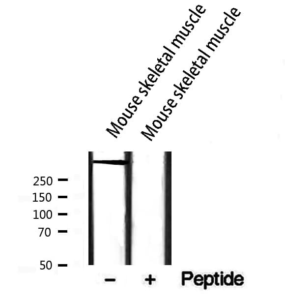 RYR2 / Ryanodine Receptor 2 Antibody