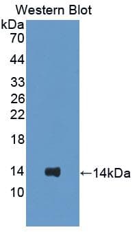 SFTPC / Surfactant Protein C Antibody (aa95-194)