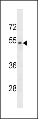 FCGRT / FCRN Antibody (aa330-357)