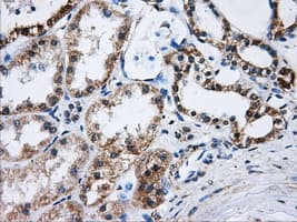 ATP5B / ATP Synthase Beta Antibody (clone OTI9E3, Carrier-free)