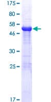 Human HDHD2 Protein (Recombinant GST)