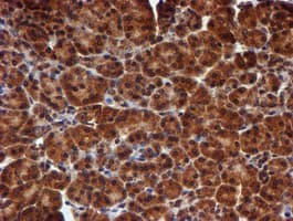 HARS2 Antibody (clone OTI5H2)