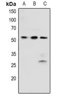 PTK6 / BRK Antibody