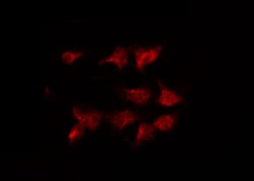 HTR2C / 5-HT2C Receptor Antibody