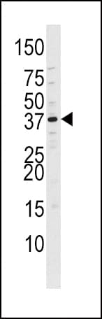 CDK7 Antibody (phospho-Thr170)