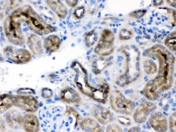 Polyclonal Rabbit anti-Human CCT4 / SRB Antibody (IHC, WB)
