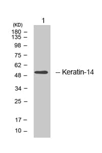 KRT14 / CK14 / Cytokeratin 14 Antibody (aa1-50)
