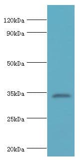 Polyclonal Rabbit anti-Human ARH / LDLRAP1 Antibody (aa59-308, IHC, WB)