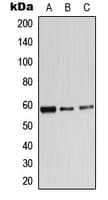 Polyclonal Rabbit anti-Human ADRA1B / Adrenoceptor alpha 1B Antibody (C-Terminus, WB)