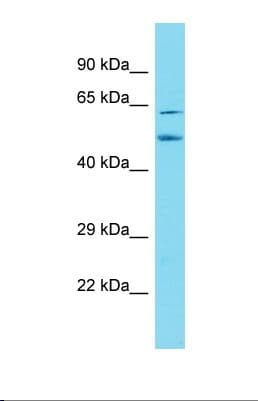 N4BP3 Antibody (aa51-100)