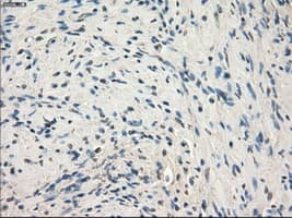 MAP2K1 / MKK1 / MEK1 Antibody (clone OTI1C1, Carrier-free)