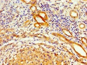 SRSF4 / SFRS4 Antibody (aa1-180)