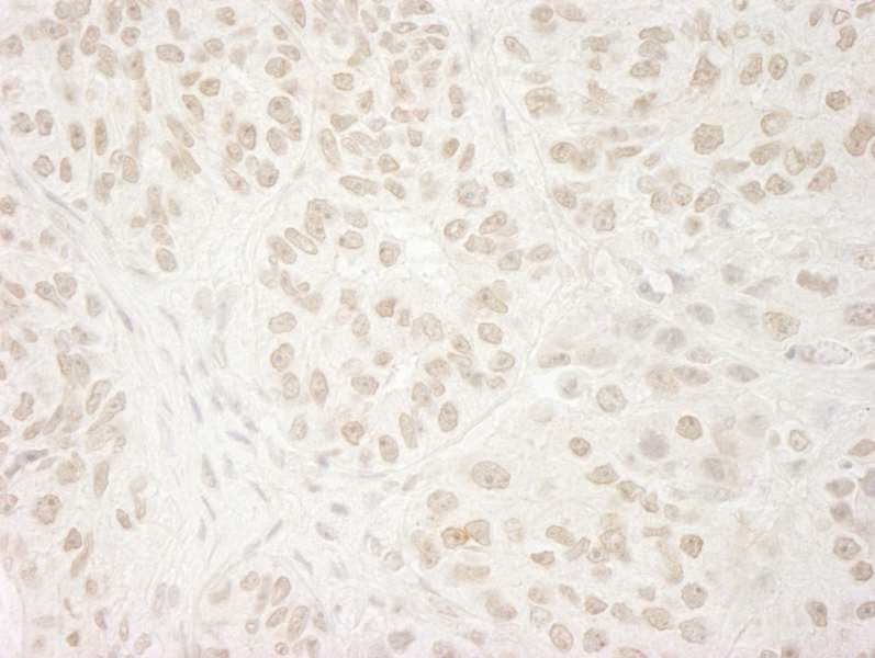 Polyclonal Rabbit anti-Human USP37 Antibody (aa930-C-term, IHC)