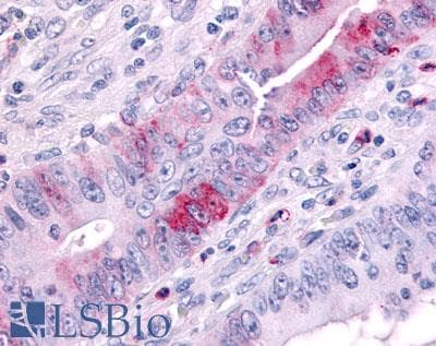 IHC-plus™ MAP3K9 / MLK1 Antibody (Internal)