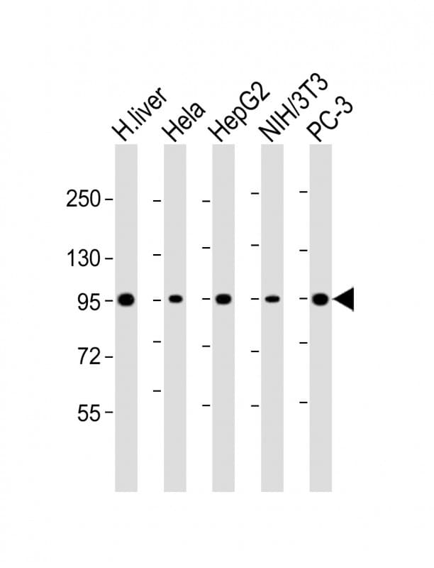Polyclonal Rabbit anti-Human PYGL Antibody (aa809-843, IHC, WB)