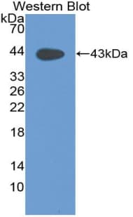 MUC5B Antibody (aa3513-3611)