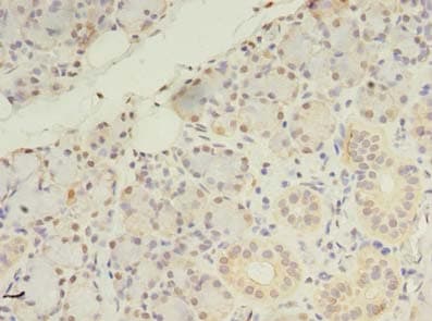 Polyclonal Rabbit anti-Human ZDHHC4 Antibody (IHC, WB)