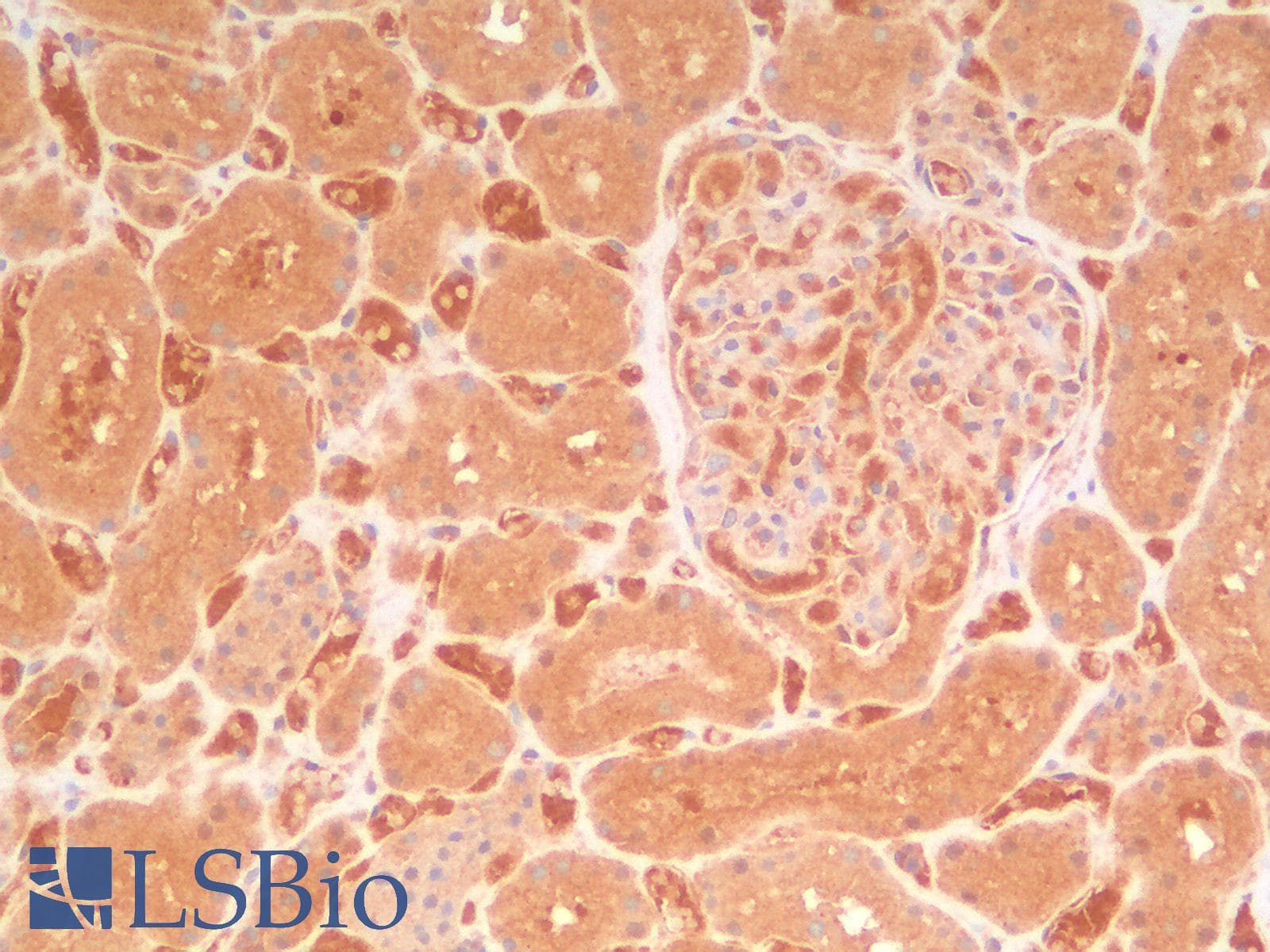 PathPlus™ AMACR / P504S Antibody (aa 297-394, clone AMACR/2748R)