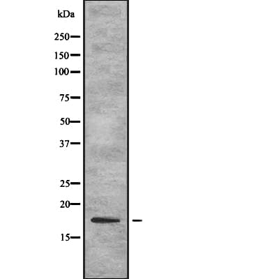 TSLP Antibody