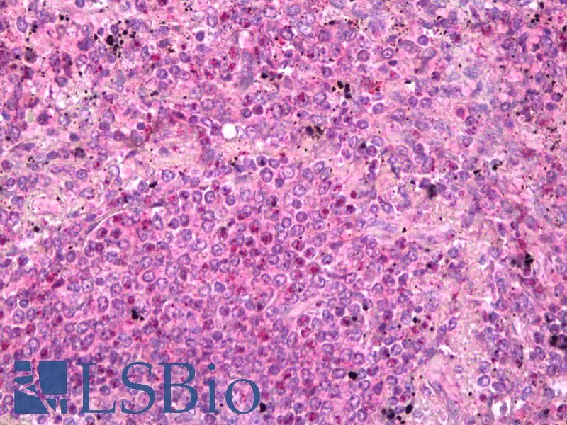 IHC-plus™ Polyclonal Rabbit anti-Human PADI1 Antibody (IHC, WB)