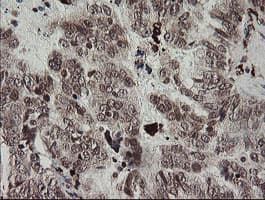 F13A1 / Factor XIIIa Antibody (clone 6F5, Carrier-free)