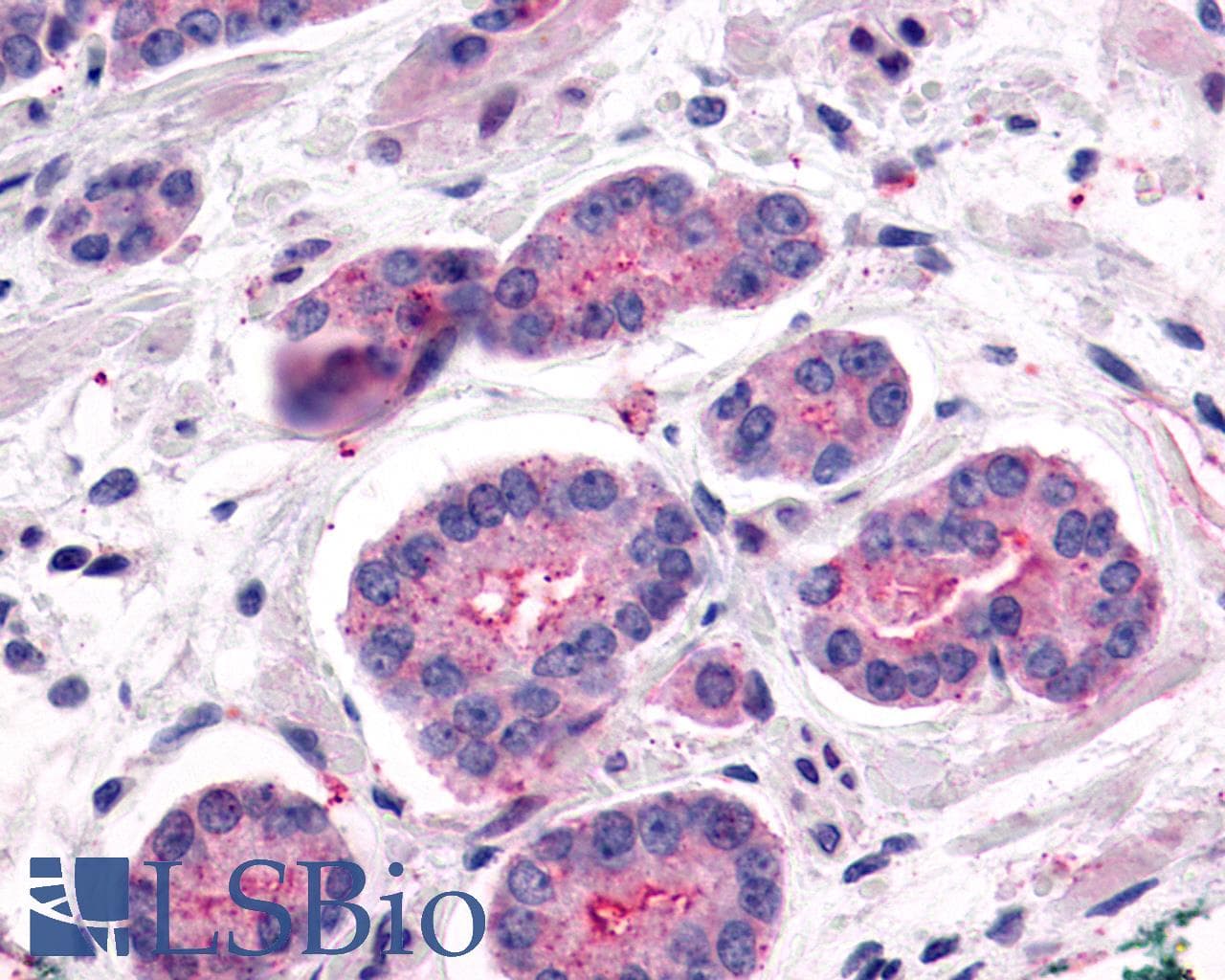 IHC-plus™ ADGRL2 / LPHN2 Antibody (C-Terminus)