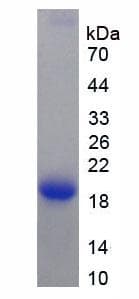 KRT12 / CK12 / Cytokeratin 12 Protein (Recombinant His-S)