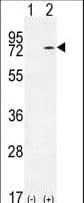 KARS Antibody (aa70-98)