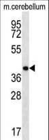 HOXD13 Antibody (aa197-226)