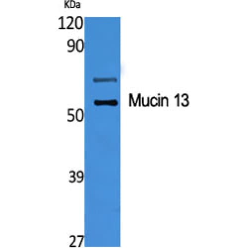 Polyclonal Rabbit anti-Human MUC13 Antibody (390-470 aa, C-terminal, IHC, IF, WB)