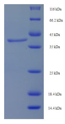 Human LHCGR / LHR / LH Receptor Protein (Recombinant His)
