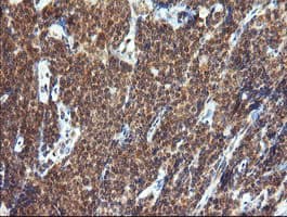 Monoclonal Mouse anti-Human TRIM44 Antibody (clone OTI1E10, IHC, IF, WB)