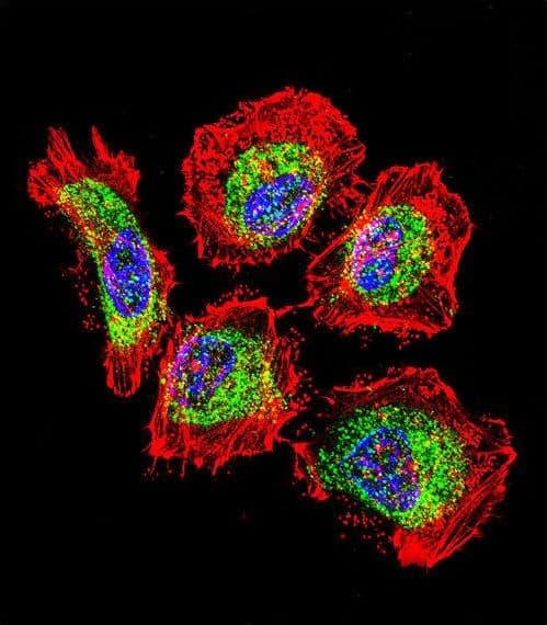 IHC-plus™ Polyclonal Rabbit anti-Human Vimentin Antibody (IHC, IF, WB)