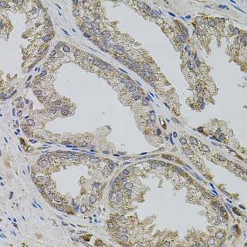 Polyclonal Rabbit anti-Human VIP Antibody (IHC, WB)