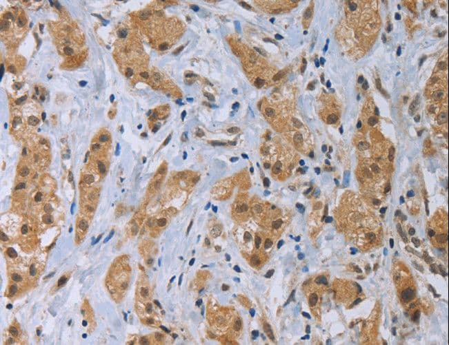 CLEC1A / CLEC-1 Antibody
