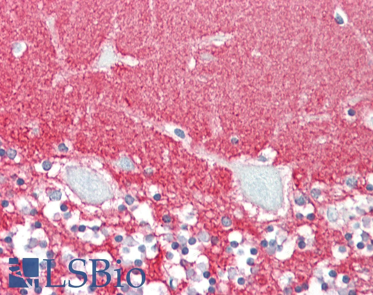 IHC-plus™ Polyclonal Goat anti-Human GPM6A / Glycoprotein M6A Antibody (aa59-70, IHC, WB)
