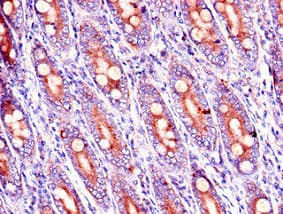 Polyclonal Rabbit anti-Human RAB39B Antibody