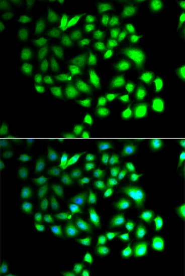 TCEAL8 Antibody