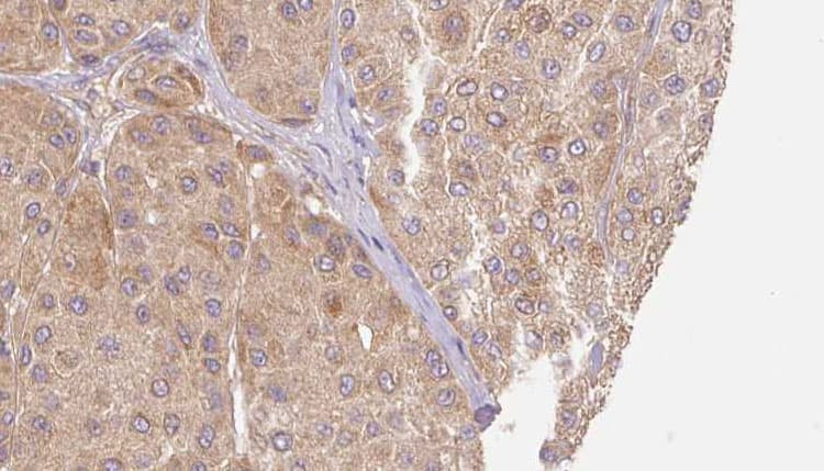 Polyclonal Rabbit anti-Human Lumican Antibody (IHC, WB)