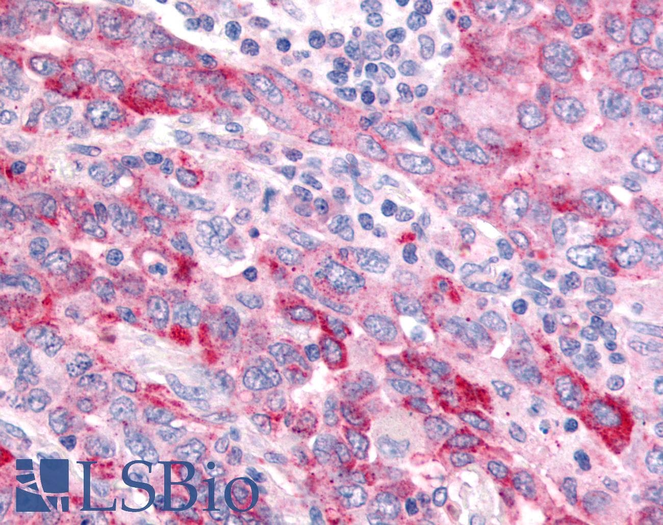 PathPlus™ WNT8A Antibody (Internal)