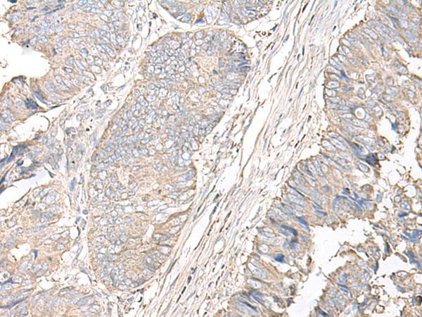 IGHA1 / IgA1 Antibody