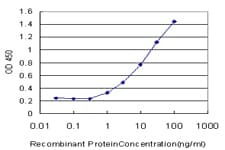 IHC-plus™ MECP2 Antibody (clone 4B6)