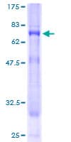 Human SYNGR3 / Synaptogyrin 3 Protein (Recombinant GST)