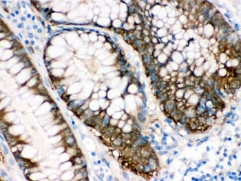 IDH1 / IDH Antibody