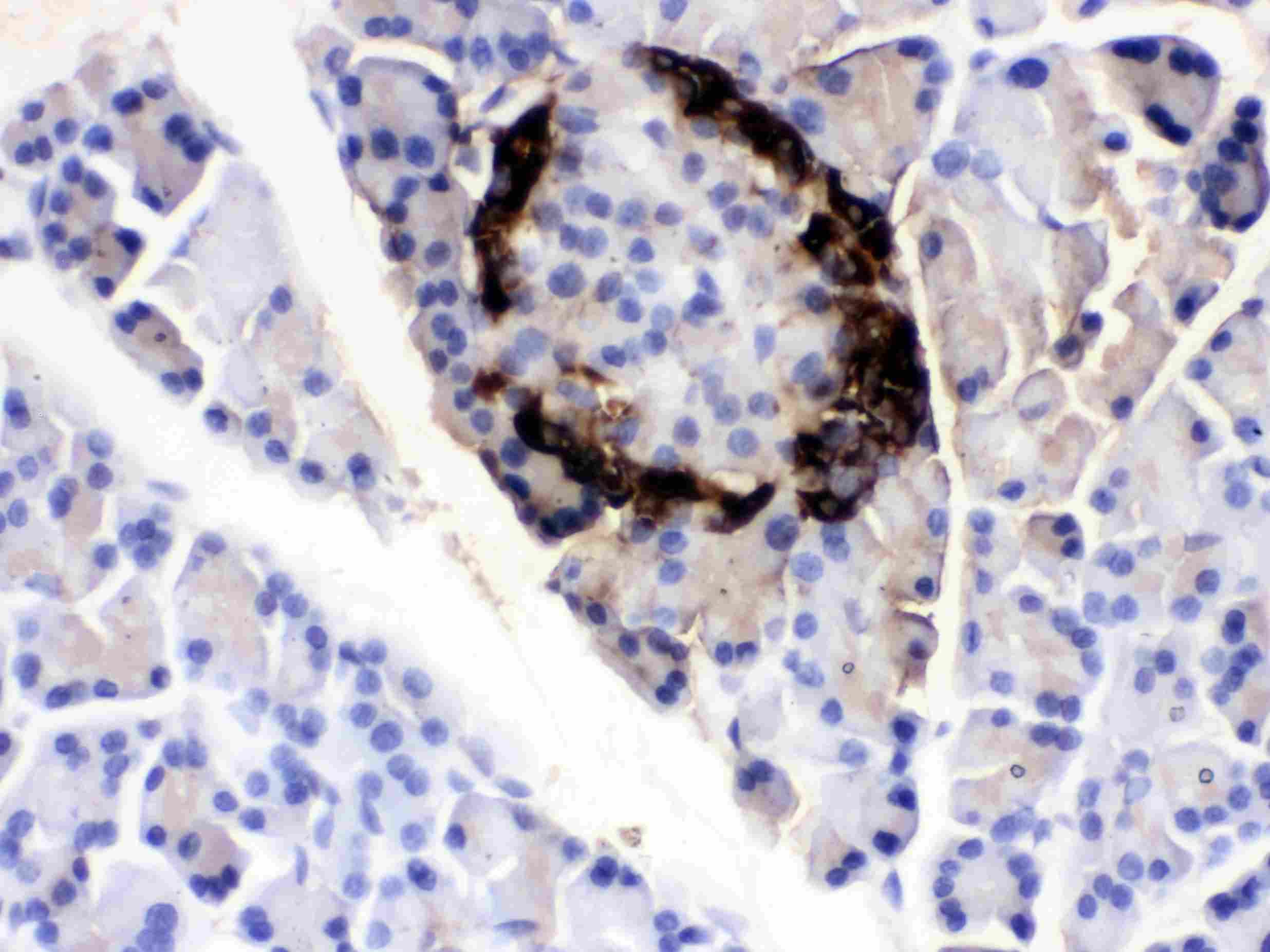 VIP Antibody