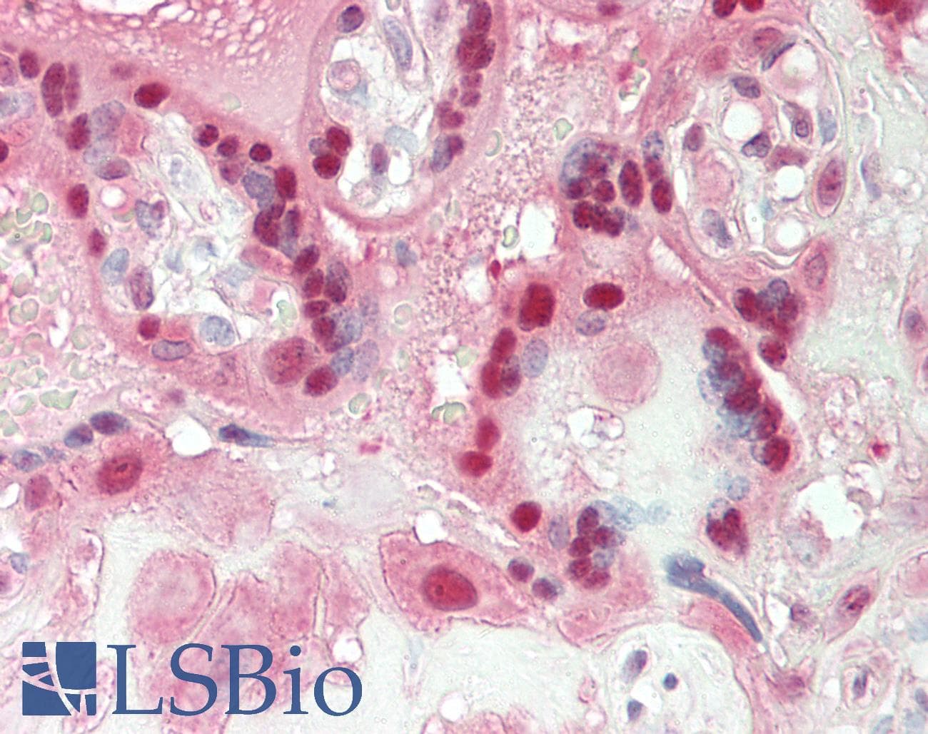 PPP1R13L / iASPP Antibody (aa501-550)