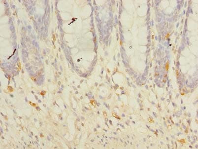 Polyclonal Rabbit anti-Human TMEM41A Antibody (IHC, WB)