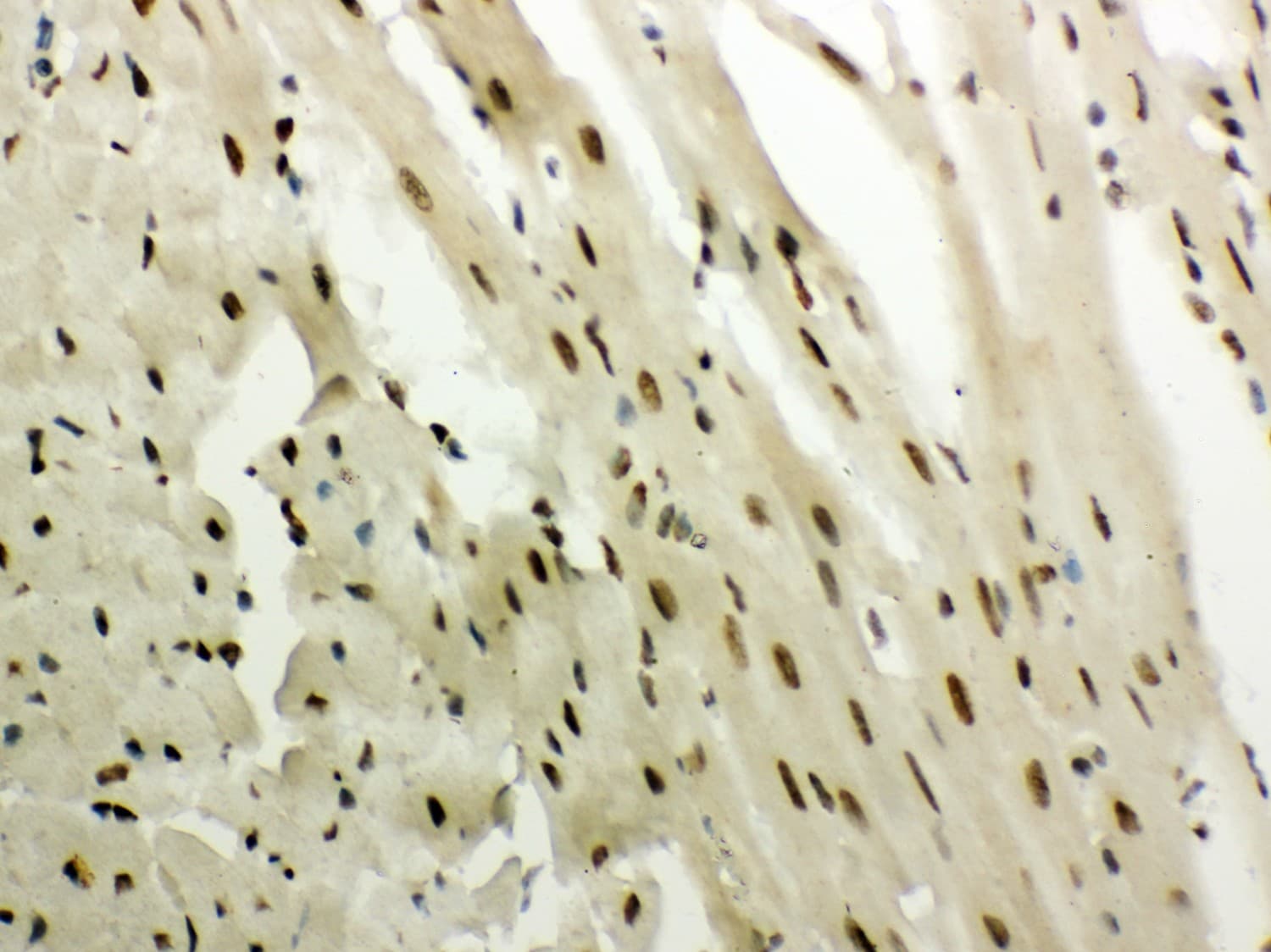 NR3C1/Glucocorticoid Receptor Antibody (aa20-199)