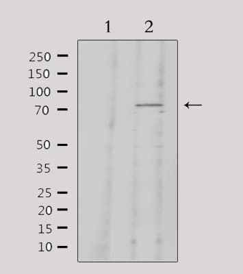 Polyclonal Rabbit anti-Human KNG1 / Kininogen / Bradykinin Antibody (IHC, IF, WB)