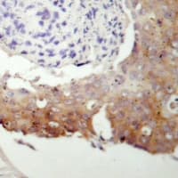 Polyclonal Rabbit anti-Human PRKG2 / CGKII Antibody (N-Terminus, IHC, WB)